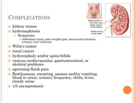 horseshoe kidney symptoms
